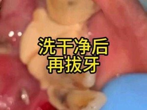 拔擦拔擦【拔擦拔擦，究竟是怎样的体验？】